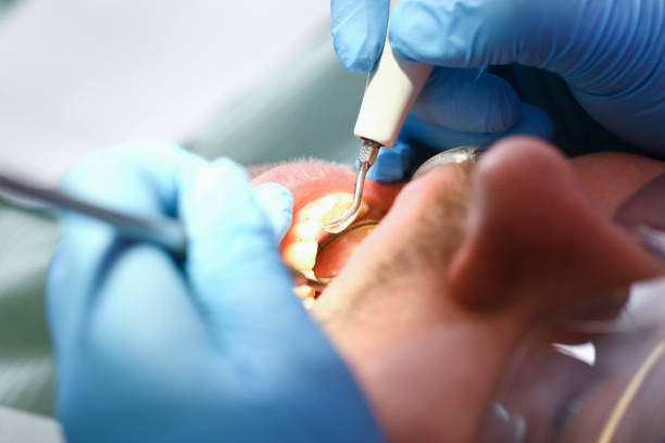 Best Pediatric Emergency Dentist in Princeton Junction, NJ
